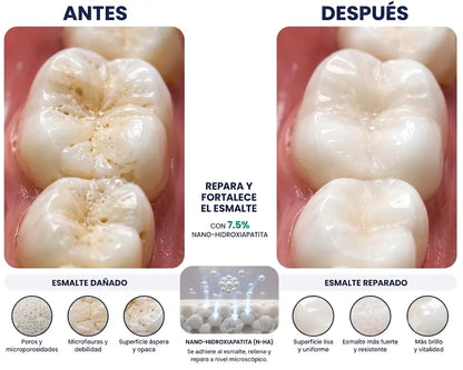 Nano Hydroxyapatite 7.5